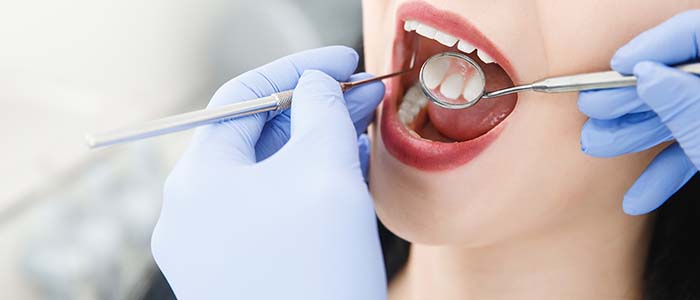 10 consejos para encontrar un dentista barato