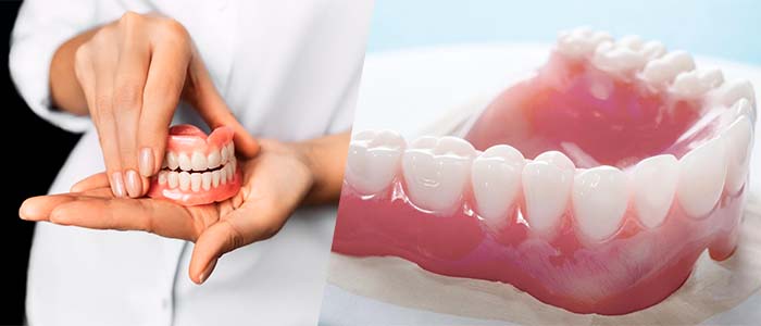 protesis dentales tipos